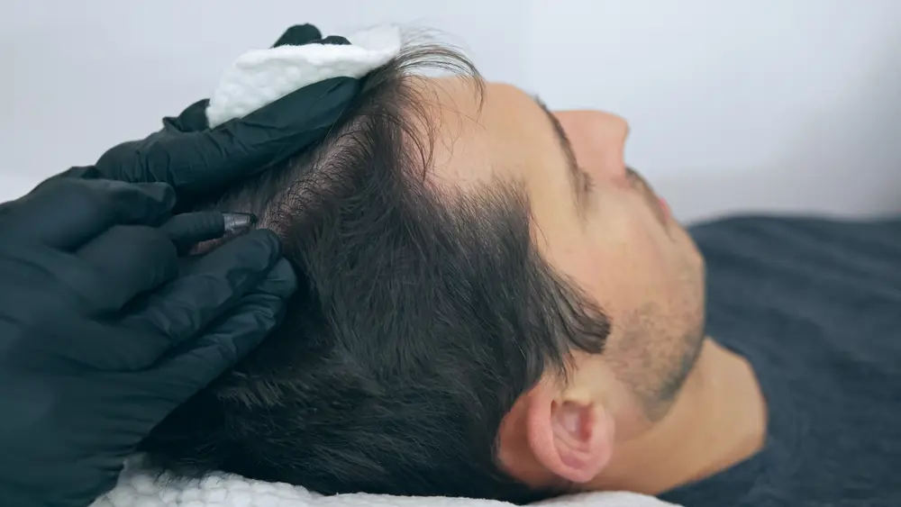 what is a scalp treatment